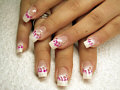 Bild 113